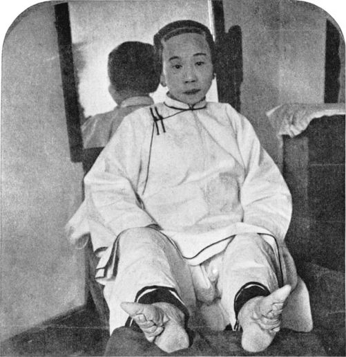Chinese lady with bound feet