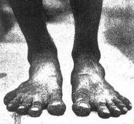 natural and baby feet